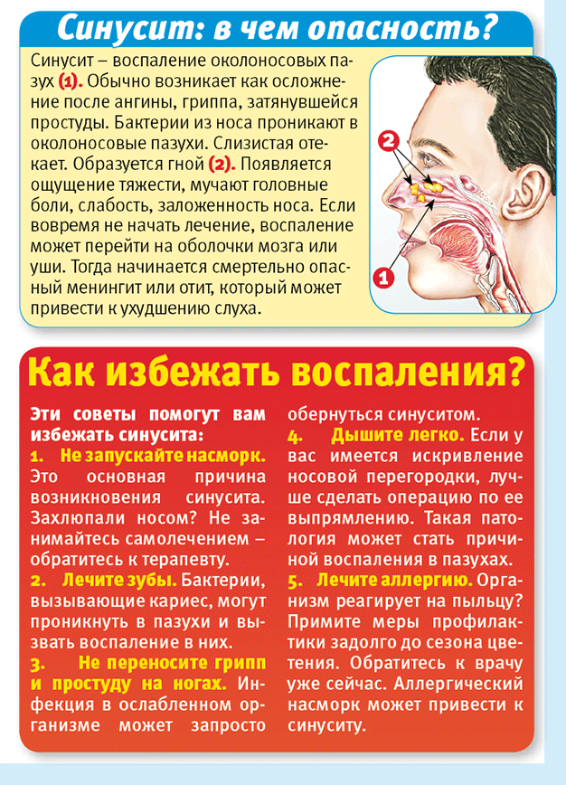 Ринит острый у беременных лечение 20