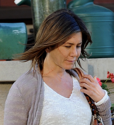 Jennifer Aniston spotted on the set of her new film 'Cake' with severe scars on her face and neck, shooting on location in Los Angeles with co-star Sam Worthington. Worthington, who kept to himself, politely asked photographers to not take pictures while