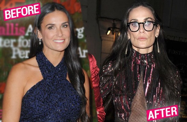 demi-moore-face-scary-skinny-weight-loss