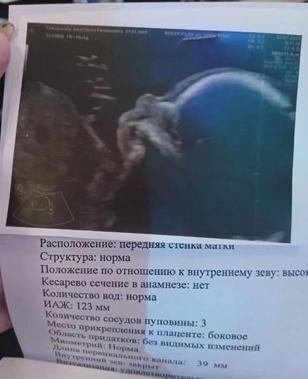 В Санкт-Петербурге задержали 36-летнюю блогершу, которую подозревают в гибели новорождённого сына - 1 Анастасия Скворцова, беременность, коуч, ребенок, УЗИ, скриннинг