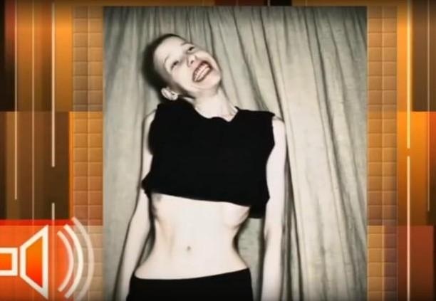 Рая Краснослободцева, анорексия, худоба, растройство пищевого поведения, РПП, питание