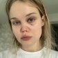 «У меня снова проседает нос»: блогер Алина Кутинская заявила об избиении во время стрима