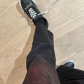Барабанщик группы Blink-182 Трэвис Баркер травмировал руку во время концерта: фото