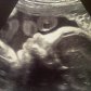 Шакира показала фото нерожденного ребенка