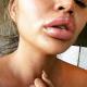 Крисси Тейген пострадала из-за обычного апельсина: губы модели распухли до ужасающего размера